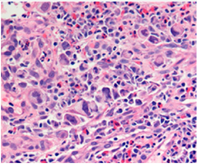 biomedres-openaccess-journal-bjstr