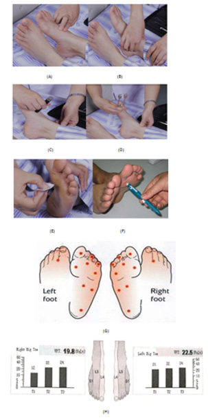 biomedres-openaccess-journal-bjstr