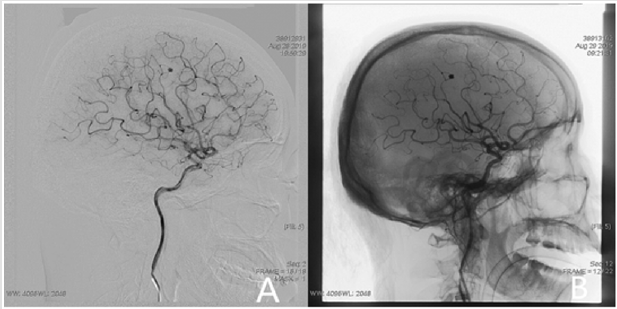 biomedres-openaccess-journal-bjstr