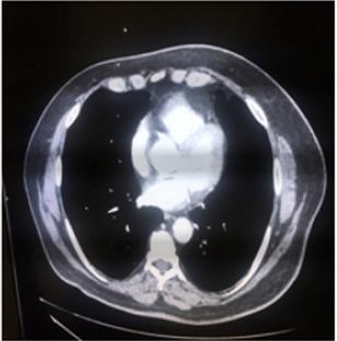 biomedres-openaccess-journal-bjstr