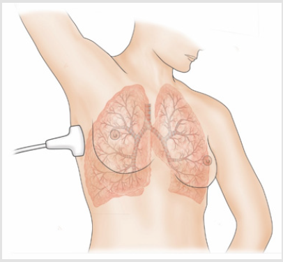 biomedres-openaccess-journal-bjstr
