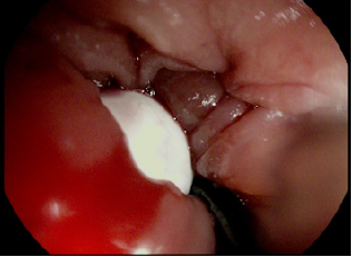 biomedres-openaccess-journal-bjstr