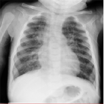 biomedres-openaccess-journal-bjstr