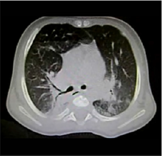 biomedres-openaccess-journal-bjstr