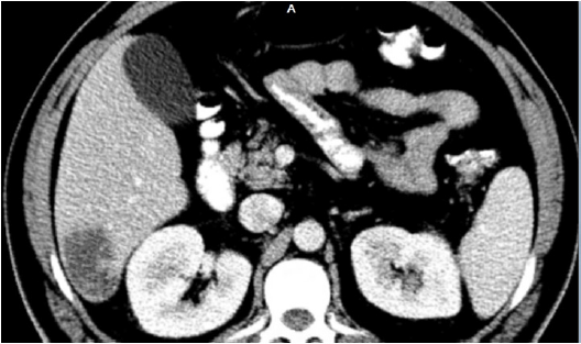 biomedres-openaccess-journal-bjstr