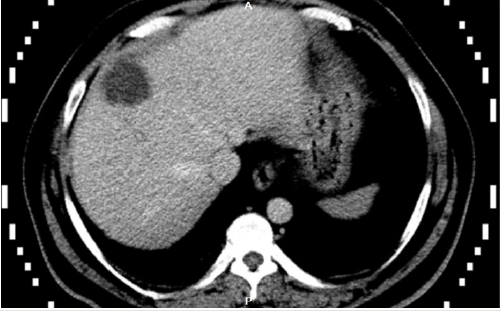 biomedres-openaccess-journal-bjstr