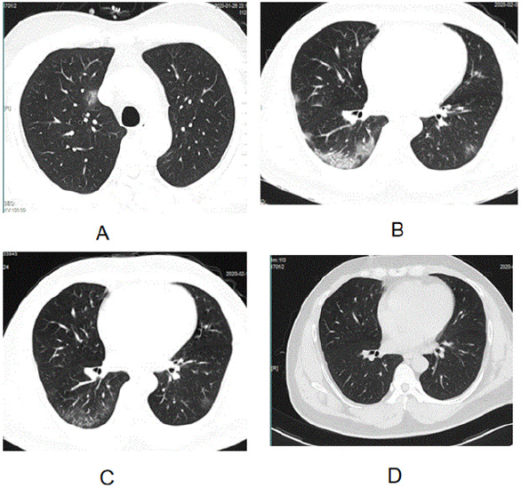 biomedres-openaccess-journal-bjstr