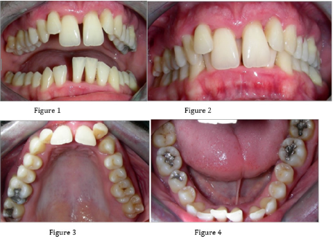 biomedres-openaccess-journal-bjstr