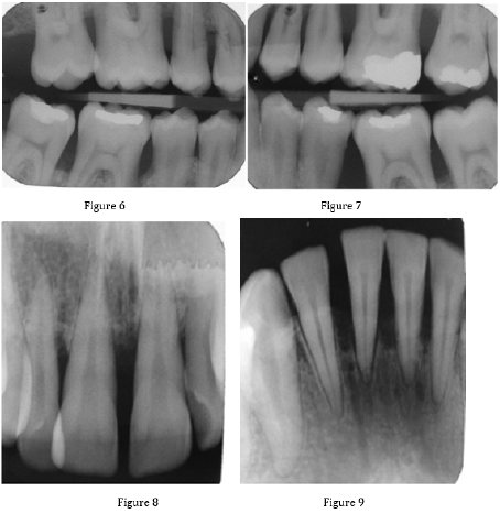 biomedres-openaccess-journal-bjstr