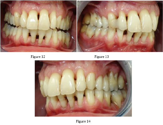 biomedres-openaccess-journal-bjstr