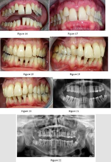 biomedres-openaccess-journal-bjstr