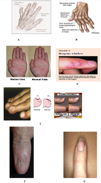 biomedres-openaccess-journal-bjstr