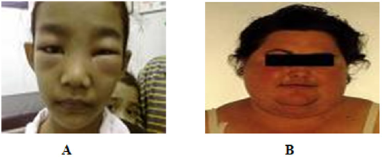 biomedres-openaccess-journal-bjstr