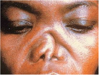 biomedres-openaccess-journal-bjstr
