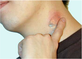 biomedres-openaccess-journal-bjstr