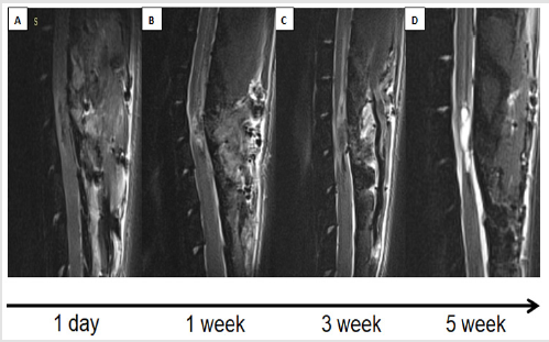 biomedres-openaccess-journal-bjstr