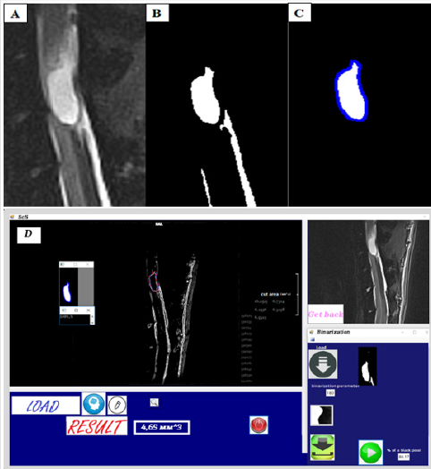 biomedres-openaccess-journal-bjstr