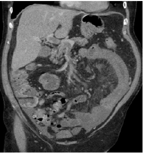 biomedres-openaccess-journal-bjstr