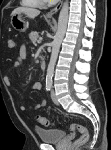biomedres-openaccess-journal-bjstr