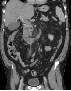 biomedres-openaccess-journal-bjstr