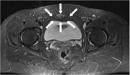 biomedres-openaccess-journal-bjstr