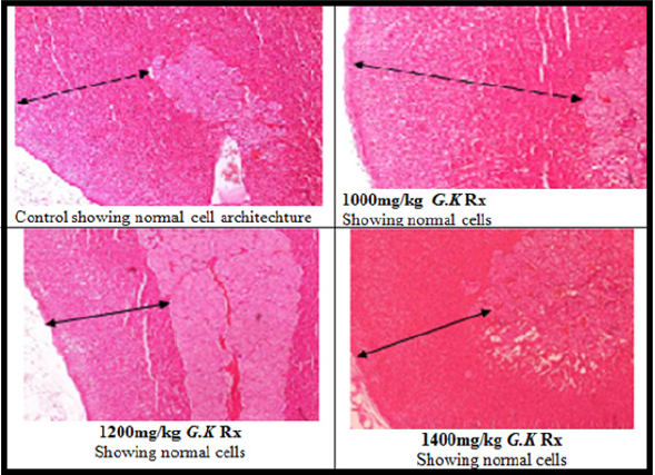 biomedres-openaccess-journal-bjstr