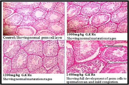 biomedres-openaccess-journal-bjstr