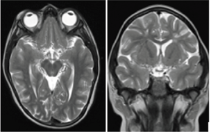 biomedres-openaccess-journal-bjstr