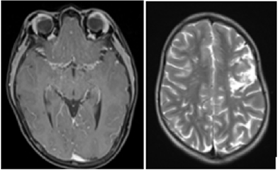 biomedres-openaccess-journal-bjstr