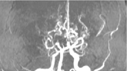 biomedres-openaccess-journal-bjstr