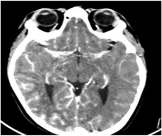 biomedres-openaccess-journal-bjstr
