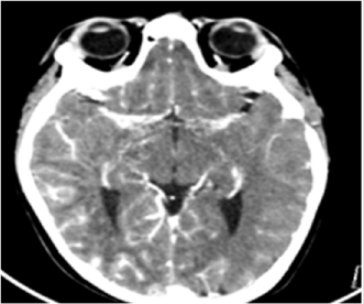 biomedres-openaccess-journal-bjstr
