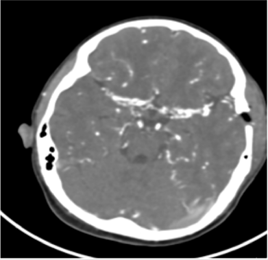 biomedres-openaccess-journal-bjstr