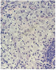 biomedres-openaccess-journal-bjstr