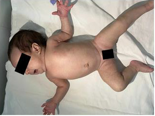 biomedres-openaccess-journal-bjstr