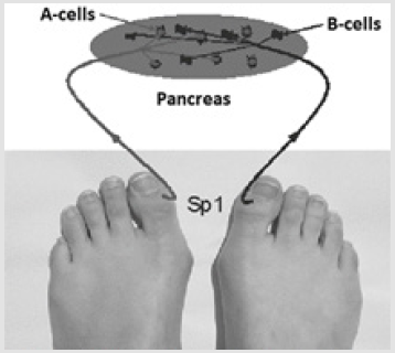 biomedres-openaccess-journal-bjstr