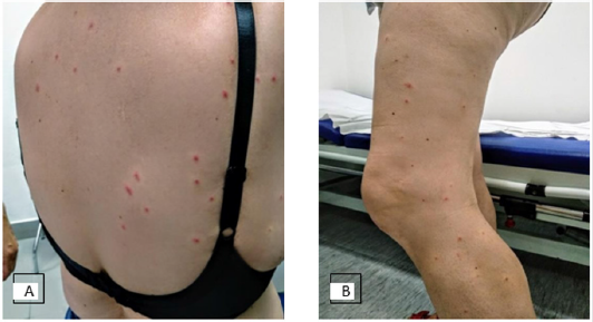 biomedres-openaccess-journal-bjstr