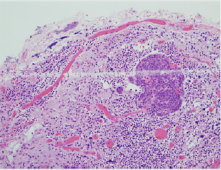 biomedres-openaccess-journal-bjstr