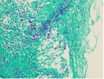 biomedres-openaccess-journal-bjstr