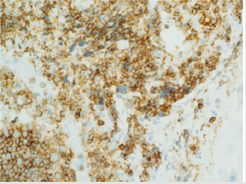biomedres-openaccess-journal-bjstr