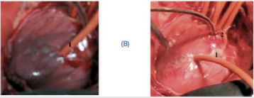 biomedres-openaccess-journal-bjstr