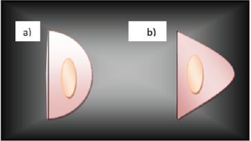 biomedres-openaccess-journal-bjstr