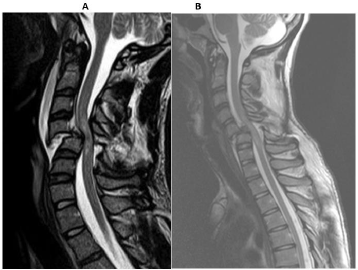 biomedres-openaccess-journal-bjstr
