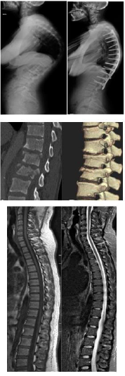 biomedres-openaccess-journal-bjstr