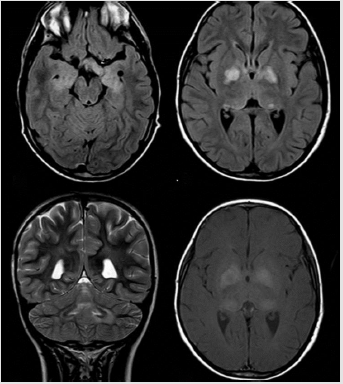 biomedres-openaccess-journal-bjstr
