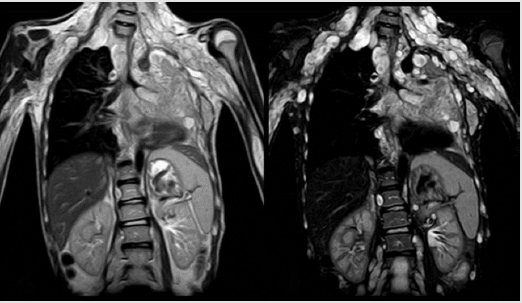 biomedres-openaccess-journal-bjstr