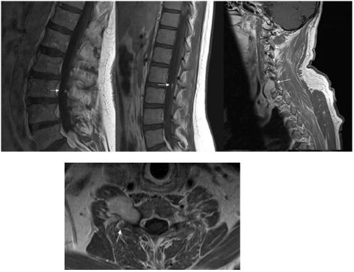 biomedres-openaccess-journal-bjstr