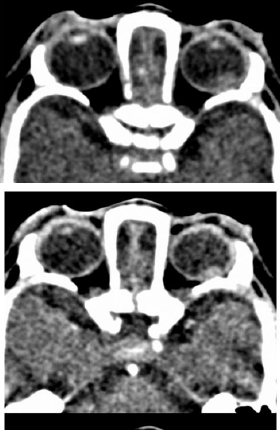 biomedres-openaccess-journal-bjstr