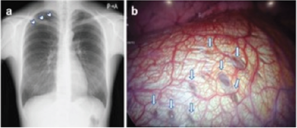 biomedres-openaccess-journal-bjstr