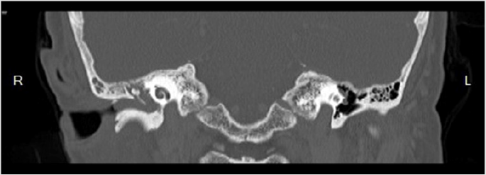 biomedres-openaccess-journal-bjstr